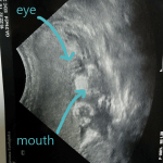 His eye, mouth, and boxing gloves are visible in this shot.